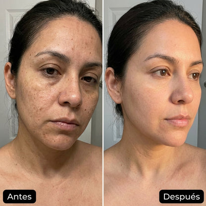 Bálsamo Facial Antiarrugas-Elimina las arrugas en 14 días